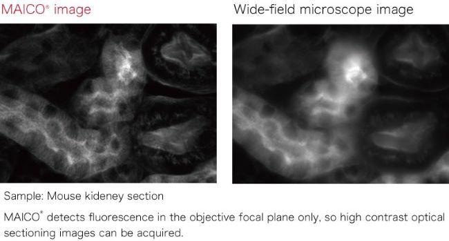 Confocal MEMS unit for fluorescence imaging