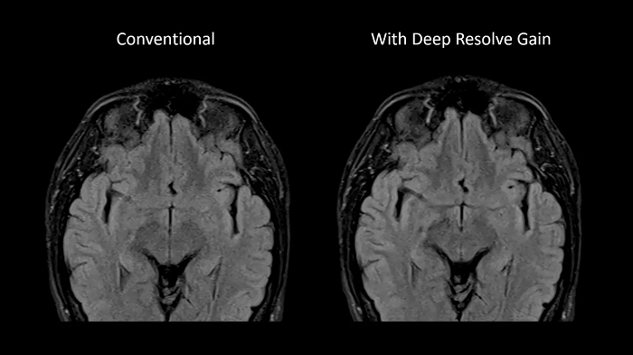 80 cm bore MAGNETOM Free.Max