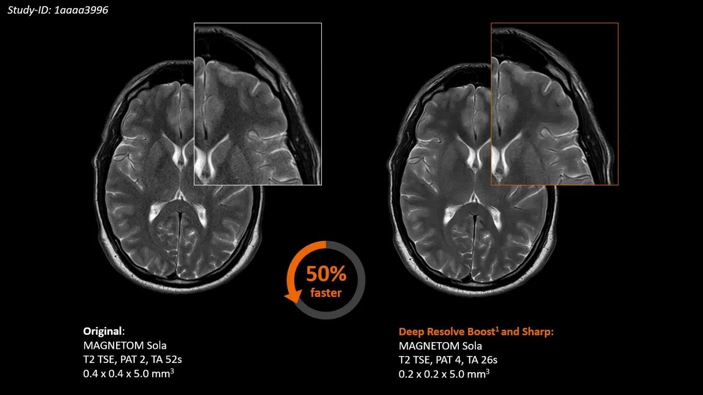 1.5T MRI system MAGNETOM Sola