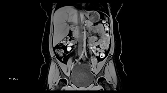3T MRI scanner MAGNETOM Vida