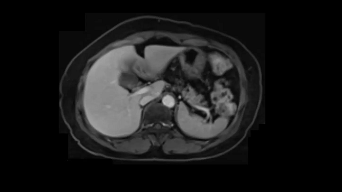 3T MRI scanner MAGNETOM Vida