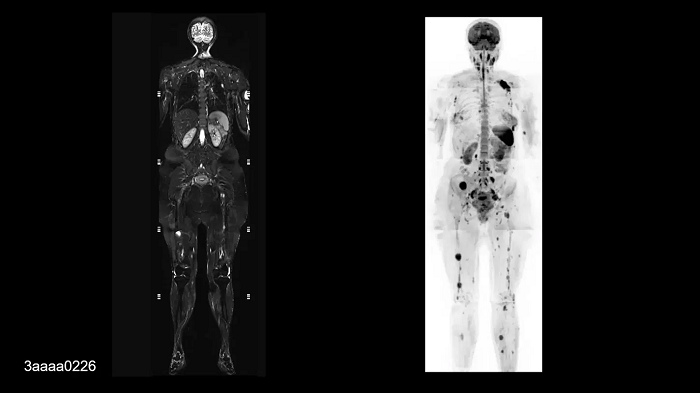 Whole-body imaging