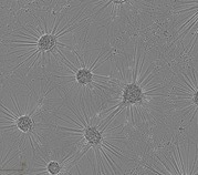 Phase contrast images of axoCells Motor Neurons matured from progenitors over 21 days.