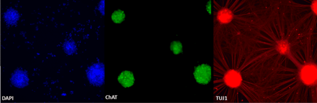 Immunocytochemistry of day 21 mature axoCells Motor Neurons demonstrating presence of key markers (ChAT and TUJ1). Images captured on a Leica microscope x20 magnification.