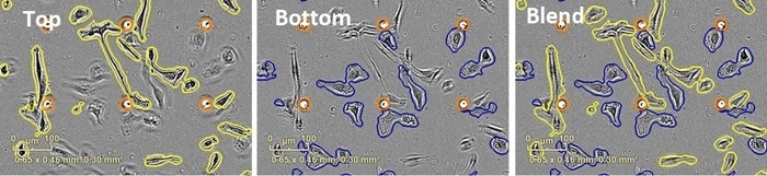 Automated image analysis. High definition phase contrast images can be acquired on both the top and bottom side of the Clearview Plate membrane. Automated image processing separates cells located on the top surface (outlined in yellow) and the bottom surface (outlined in blue) of the membrane. Pores are outlined in orange. Images are processed as they are acquired, and data can be plotted in real-time