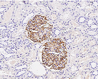 Immunochemical staining of human CD35 in human kidney.