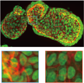 Organoid imaging example. Upper：25 μm pinhole. Lower：50 μm pinhole