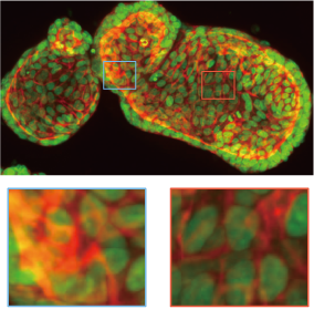 Organoid imaging example. Upper：25 μm pinhole. Lower：50 μm pinhole