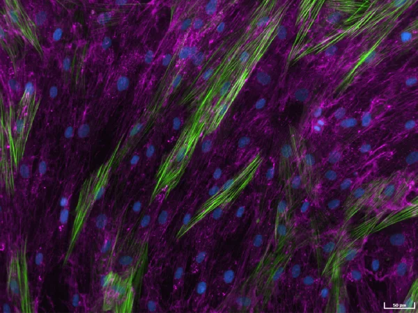 Human lung fibroblasts stimulated with TGF-β1 to detect extracellular collagen I (pink), alpha-smooth muscle actin (α-SMA) (green) and cell nuclei (blue) as a measure of matrix production and fibroblast activation, respectively