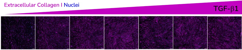 Extracellular collagen I deposition in response to dose dependent treatment with TGF-β1. Images were acquired using the ImageXpress Confocal HT.ai imaging system