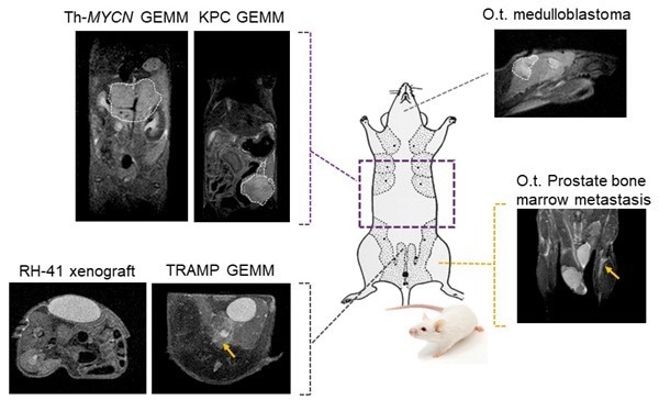 Tumor visualization in various cancer models: Fat-suppressed T2-weighted imaging can be used to detect and quantitatively characterize the growth of a wide range of cancer models