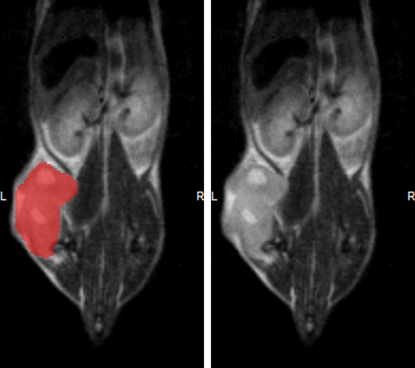Monitoring the growth of xenograft tumor grown in the mouse hindlimb is identified with T2-weighted images. Segmentation of tumor region of interests (in red) on each tumor-containing slice allows accurate volume quantification