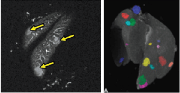 Ex vivo imaging of liver, allowing lesions to be identified, counted and measured (volume) as well as guide tissue sectioning for conventional pathological examination.