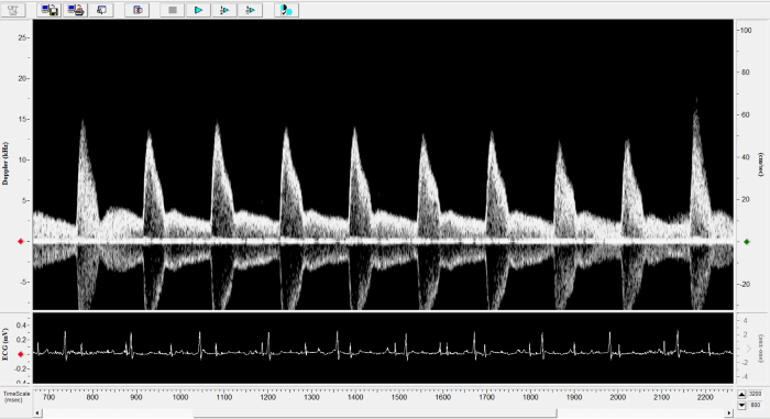 Mouse - Abdominal Aorta