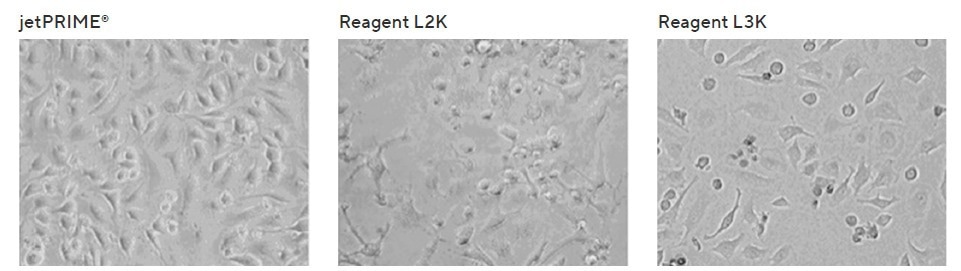 Boost DNA and siRNA transfection efficiency with jetPRIME® technology