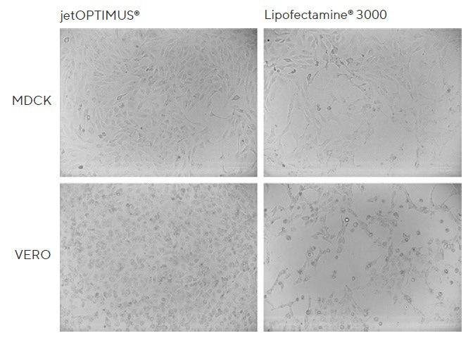 Optimize gene expression with jetOPTIMUS® high-efficiency DNA transfection