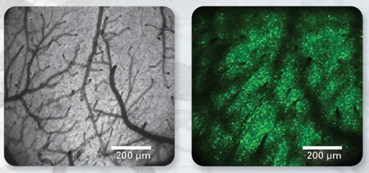 (Left) Exemplary two-photon imaging of cortical surface through a cranial glass window on Ultima 2Pplus. (Right) GCaMP6s expression in layer 5A neurons of mouse visual cortex at a depth of ~400 μm below the pia. Both acquired with Nikon 16x 0.8 NA objective at 920 nm. Scale 200 μm. Data courtesy of Dustin Herrmann, Mehmet Fisek, Michael Häusser’s lab, UCL, London