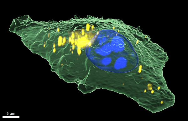 3D Raman image of a human epithelial cancer cell rendered in Imaris.