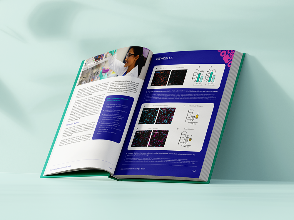 ebook on lung research