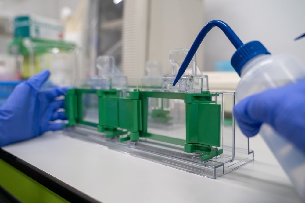 microorganism electrophoresis