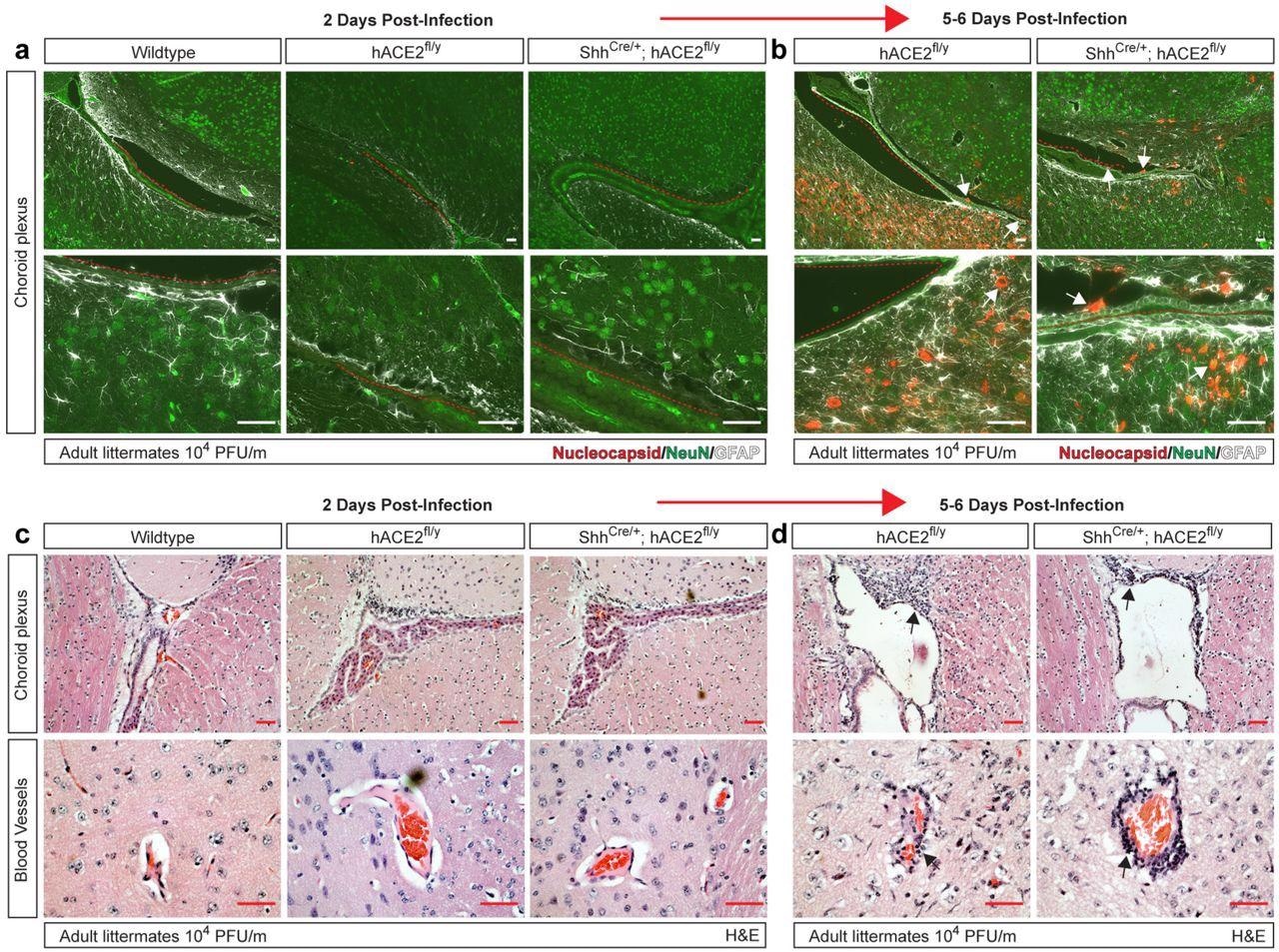 eningeal and vascular inflammation is associated with neuronal infection at the choroid plexus. a-b, Immunohistochemistry of SARS-CoV-2 nucleocapsid, neuronal NeuN and glial cell GFAP of the cerebral cortex adjacent to the choroid plexus 2 and 5-6 days after infection. Arrows indicated nucleocapsid staining. Red dotted lines trace ependymal cells of the choroid plexus. c-d, H&E staining of brain choroid plexus and cerebral cortex blood vessels 2 and 5-6 days after infection of hACE2fl/y and ShhCre/+; hACE2fl/y mice. Arrows indicate sites of immune cell infiltration. Representative of