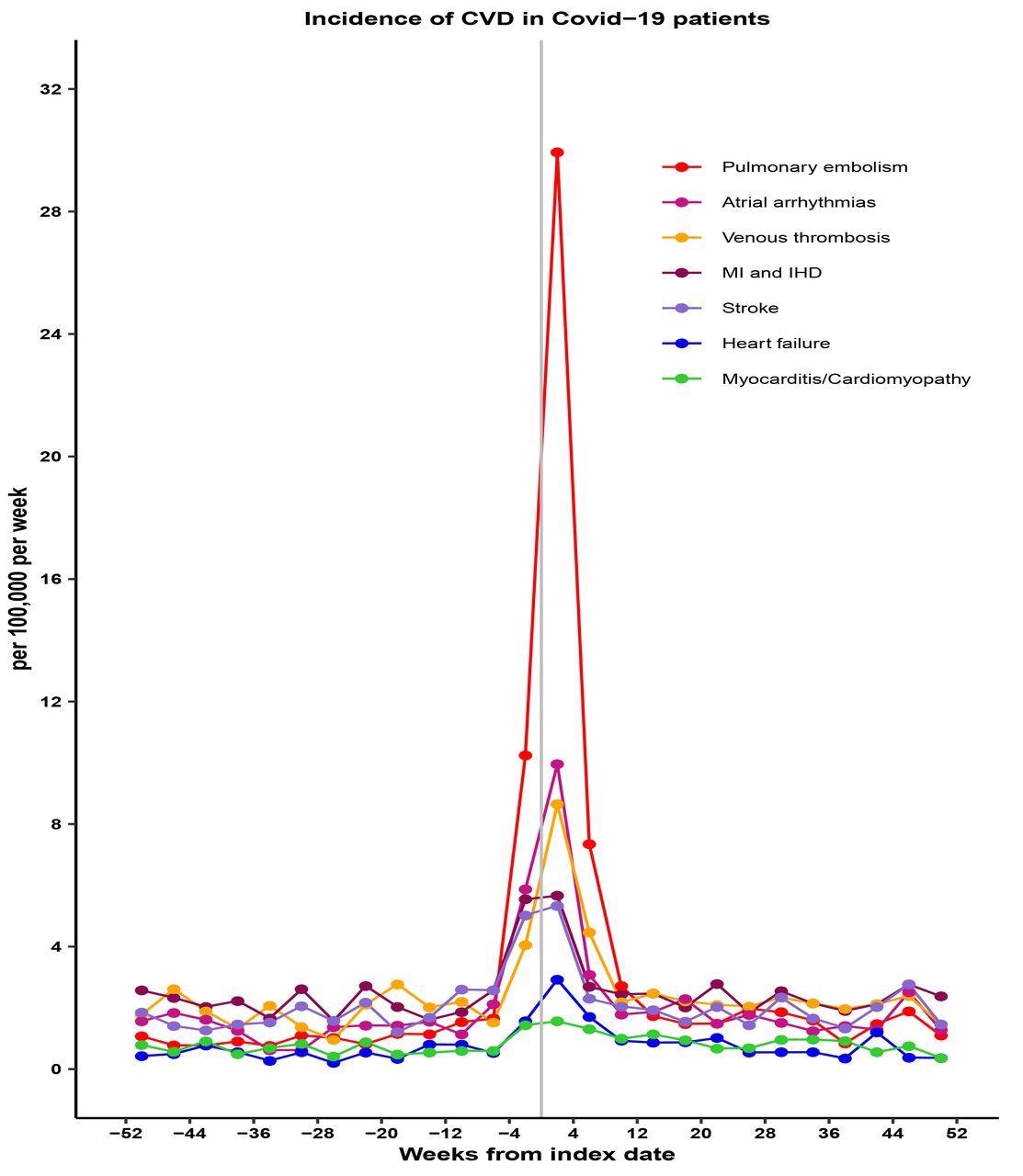 Incidence rates for categories of cardiovascular disease (per 100,000 patient weeks) for Covid-19 patients by 4-week periods.