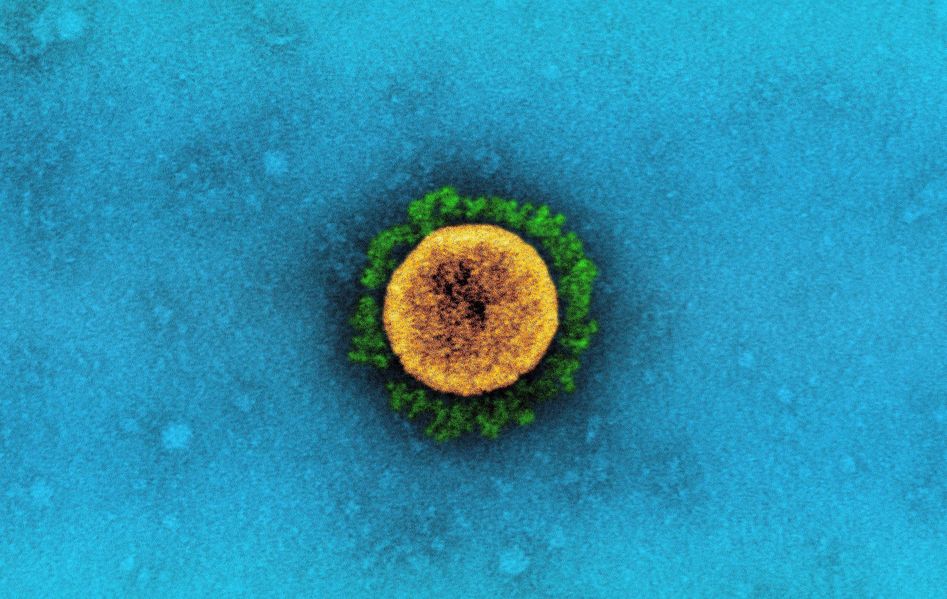 Study: Electrochemiluminescent nanostructured DNA biosensor for SARS-CoV-2 detection. Image Credit: NIAID