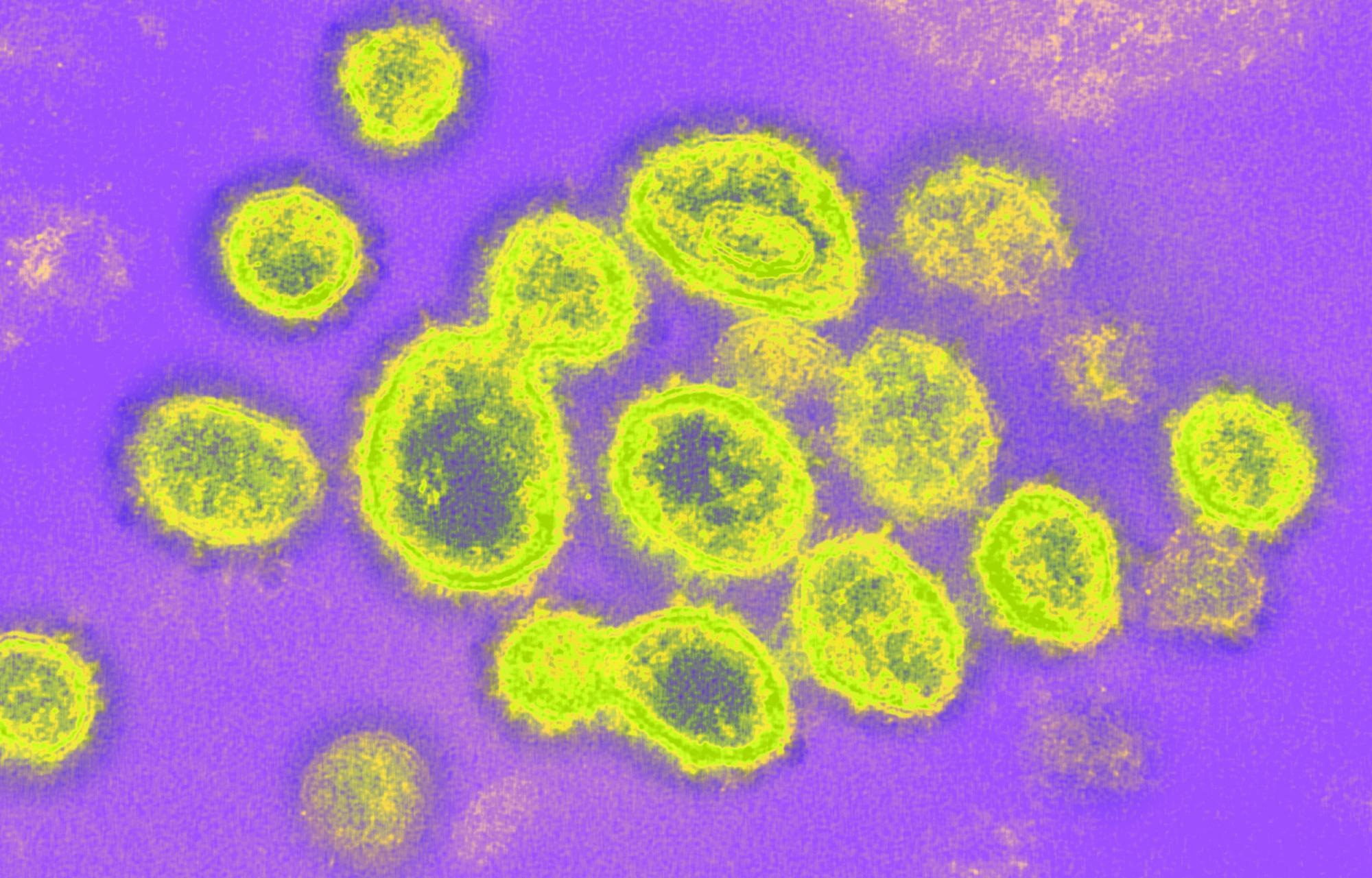 Study: Egg-derived anti-SARS-CoV-2 immunoglobulin Y (IgY) with broad variant activity as intranasal prophylaxis against COVID-19: preclinical studies and randomized controlled phase 1 clinical trial. Image Credit: NIAID