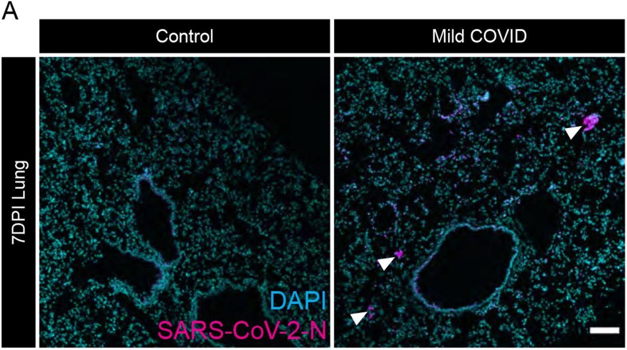 Evidence of SARS-CoV-2 infection in lung of mild respiratory COVID mouse model (A) Representative confocal micrographs of SARS-CoV-2 nucleocapsid protein (SARS- CoV-2-N, magenta; DAPI, cyan) in mouse lung 7-days post-infection. Arrowheads highlight SARS-CoV-2-N nucleocapsid protein immunostaining. Scale bar 100μm.