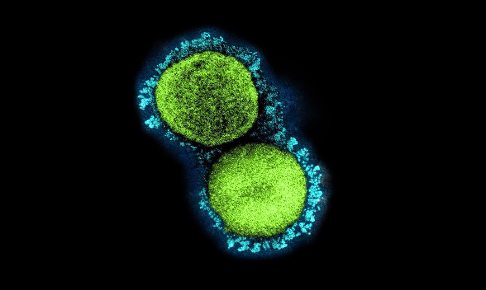 Study: Iga Vasculitis And COVID-19 In Children: A Systematic Review. Image Credit: NIAID