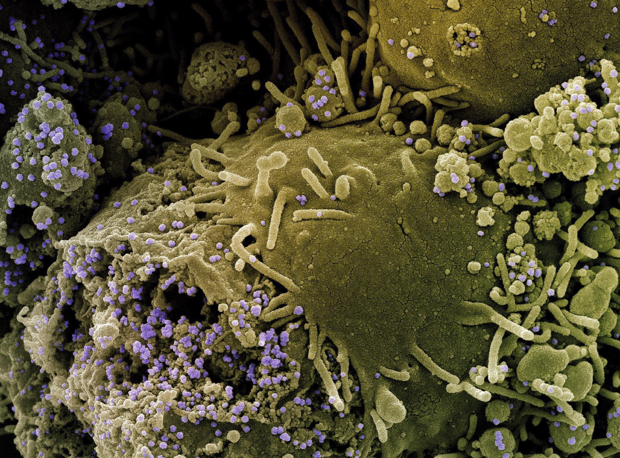 Study: Effect of an amyloidogenic SARS-COV-2 protein fragment on α-synuclein monomers and fibrils. Image Credit: NIAID