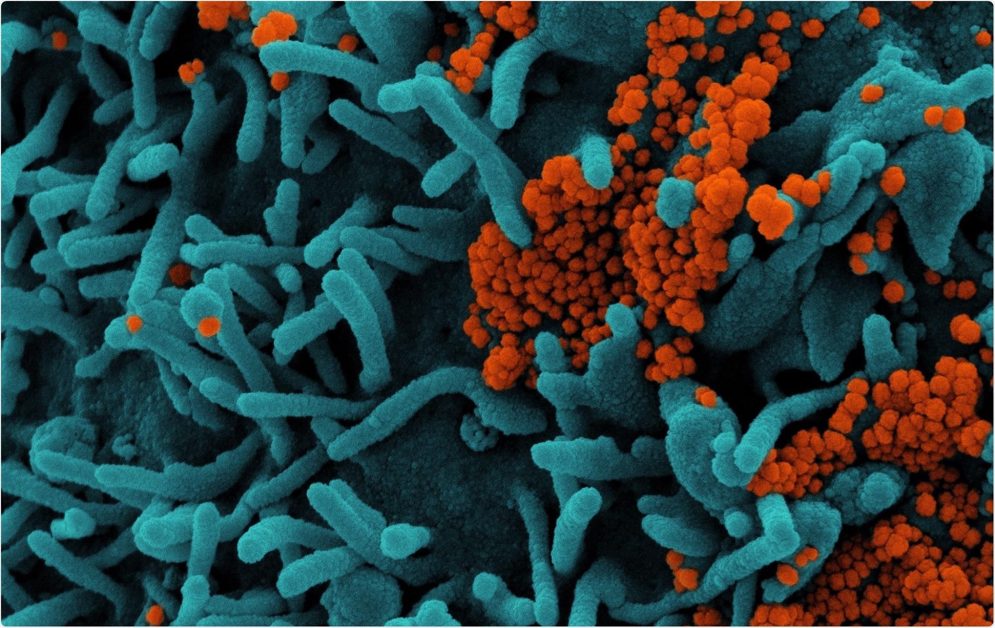 Study: Morning SARS-CoV-2 testing yields better detection of infection due to higher viral loads in saliva and nasal swabs upon waking. Image Credit: NIAID