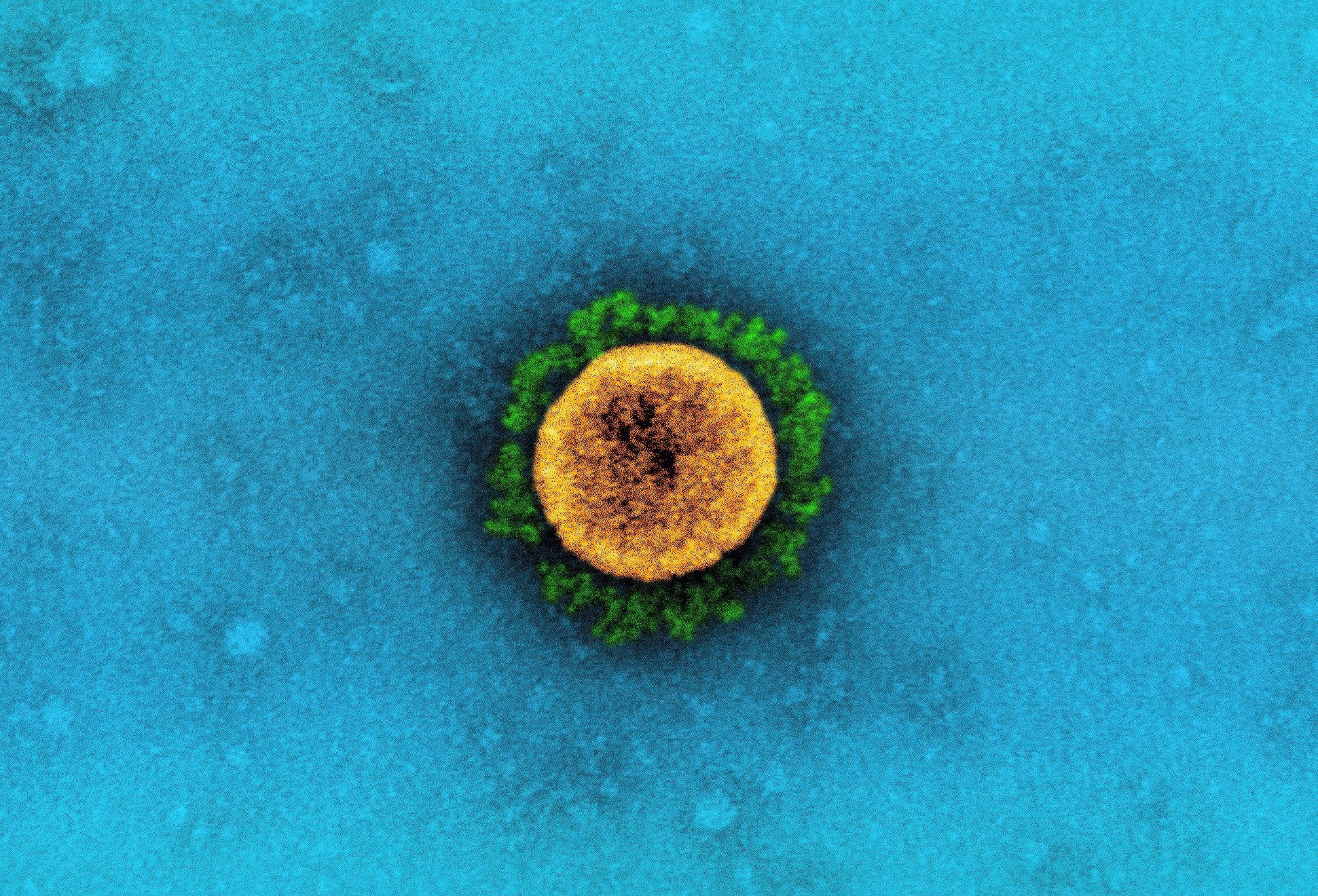 Study: Effect of Early Treatment with Ivermectin among Patients with Covid-19. Image Credit: NIAID