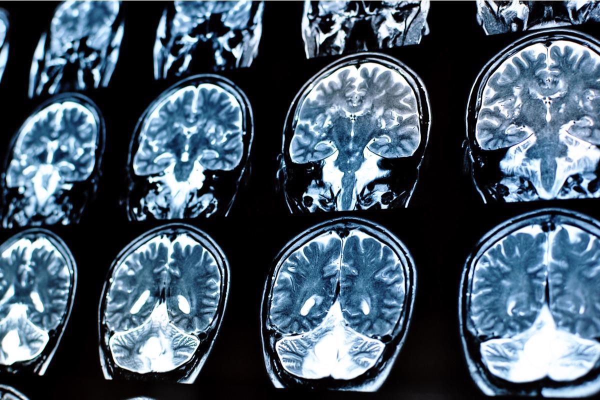 Study: Brain Charts for The Human Lifespan. Image Credit: Alina Bratosin / Shutterstock.com