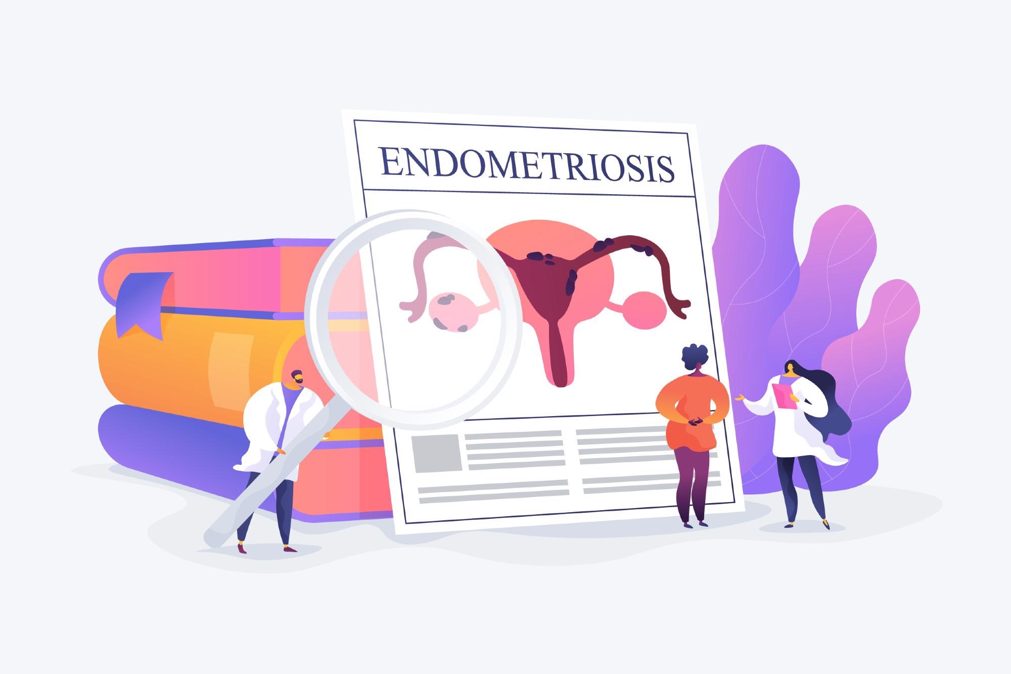 Endometriosis