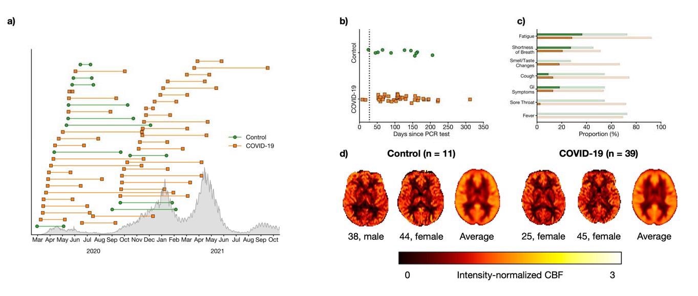 a) Timing of PCR test (left marker) and assessment (right marker) for COVID-19 (orange squares) participants and controls (green circle). Confirmed cases in Ontario are shown in grey. b) Number of days between PCR test and assessment. The black dotted line indicates 28 days, an established threshold beyond which symptoms can be considered part of the post- COVID-19 condition. c) Proportion of participants who self-reported flu-like symptoms. Faint bars indicate participants whose symptoms had resolved by the time of the assessment while dark bars indicate participants with on-going symptoms. d) Representative and group-averaged CBF maps from both groups.