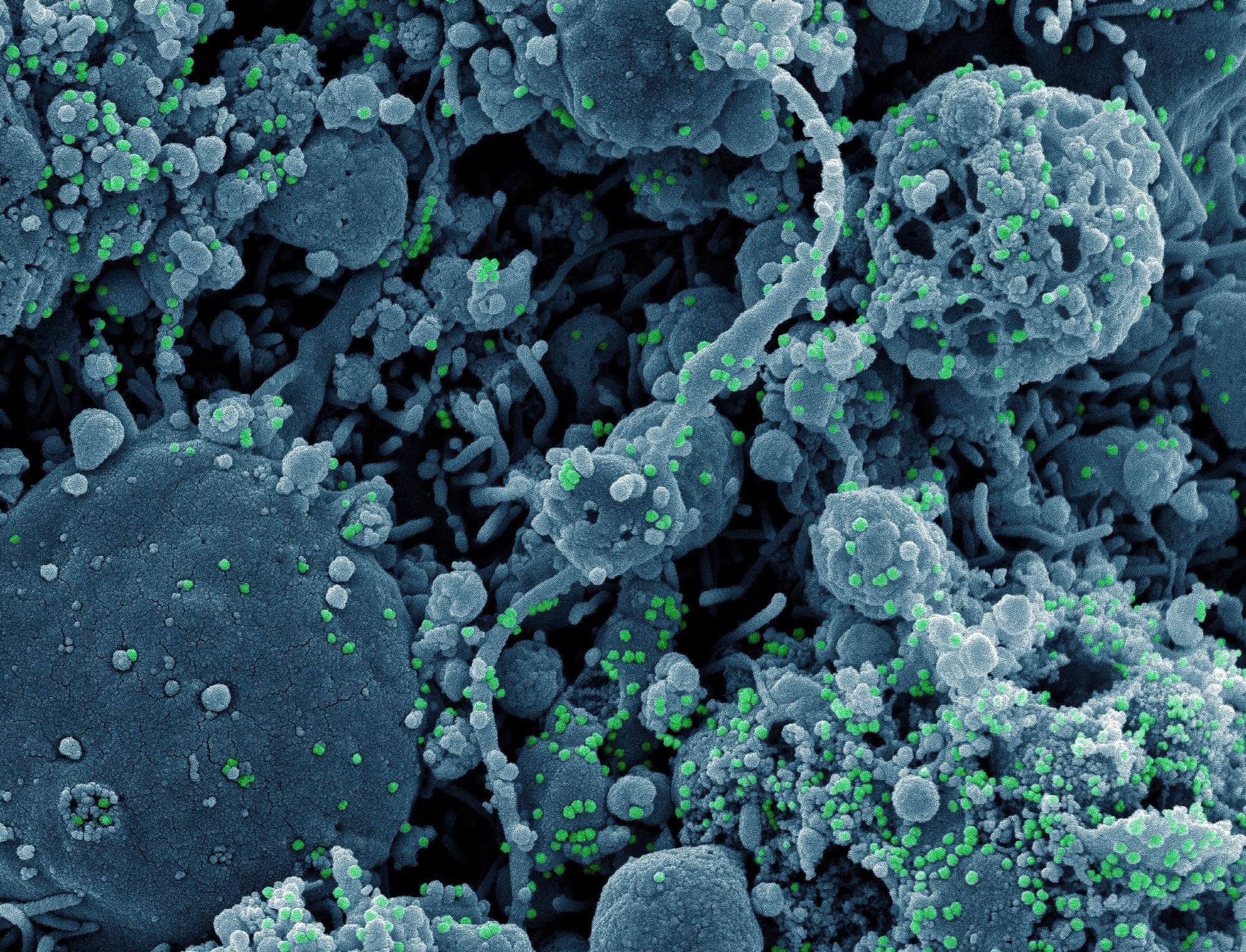 Study: Potential antiviral effects of pantethine against SARS-CoV-2. Image Credit: NIAID