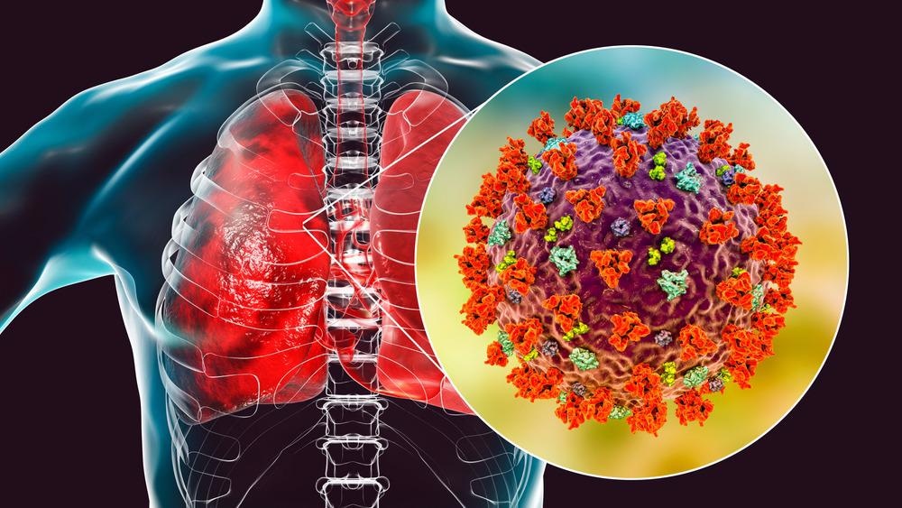 Study: Immediate myeloid depot for SARS-CoV-2 in the human lung. Image Credit: Kateryna Kon / Shutterstock.com