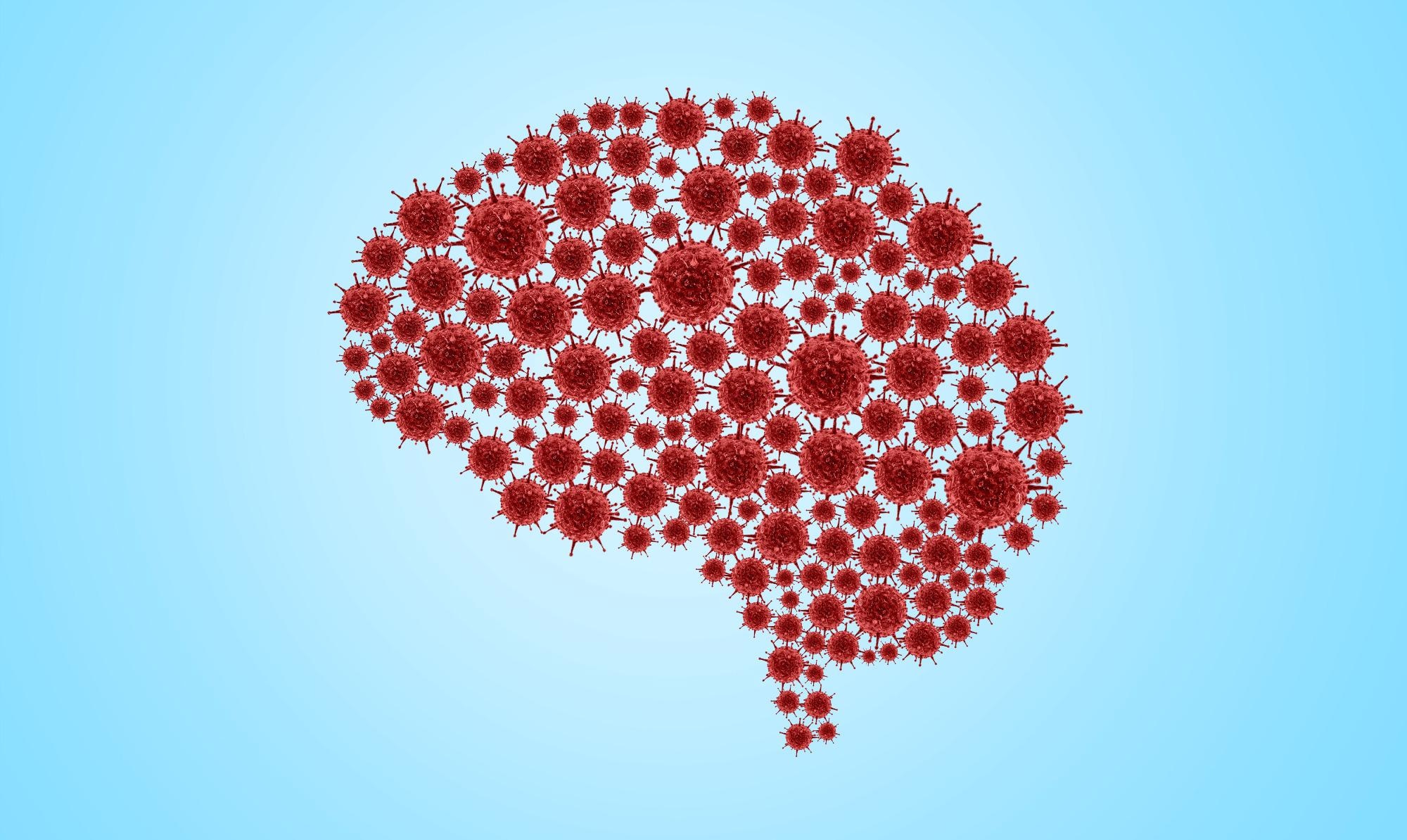 Study: Long COVID is associated with extensive in-vivo neuroinflammation on [18F]DPA-714 PET. Image Credit: DOERS / Shutterstock