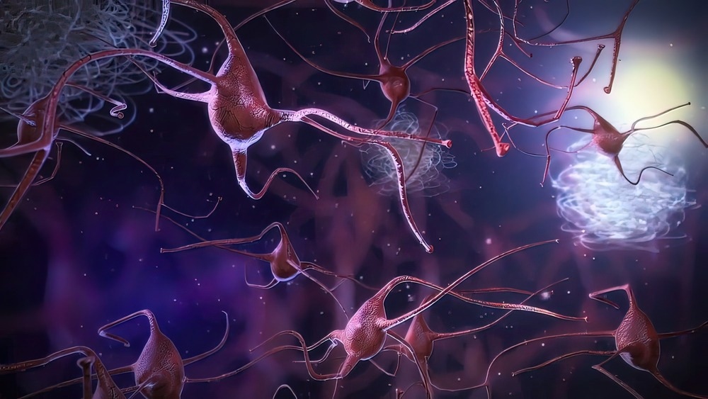 Study: Age-dependent effects of gut microbiota metabolites on brain resident macrophages. Image Credit: picmedical / Shutterstock.com