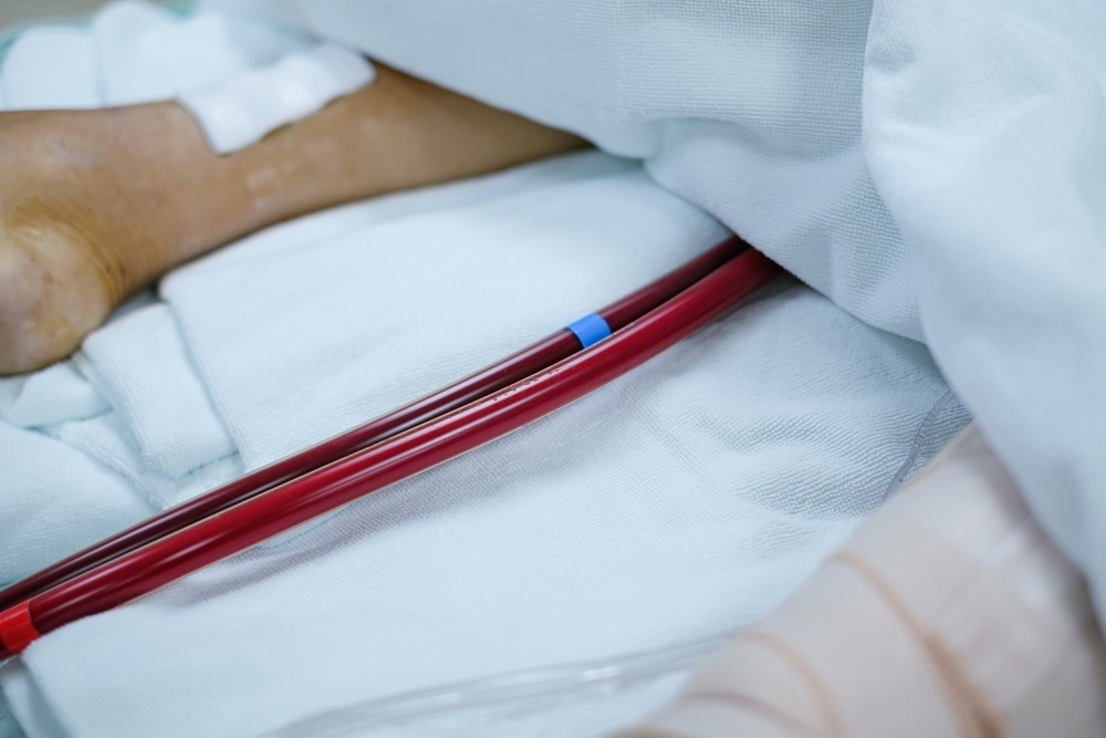 Study: Mortality of COVID-19 Patients Requiring Extracorporeal Membrane Oxygenation During the Three Epidemic Waves. Image Credit: PIJITRA PHOMKHAM/Shutterstock