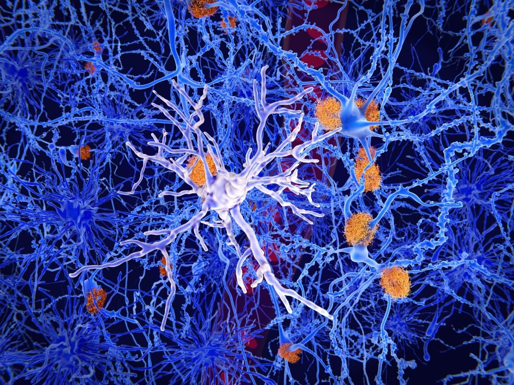 Study: Emerging roles of innate and adaptive immunity in Alzheimer’s disease. Image Credit: Juan Gaertner/Shutterstock