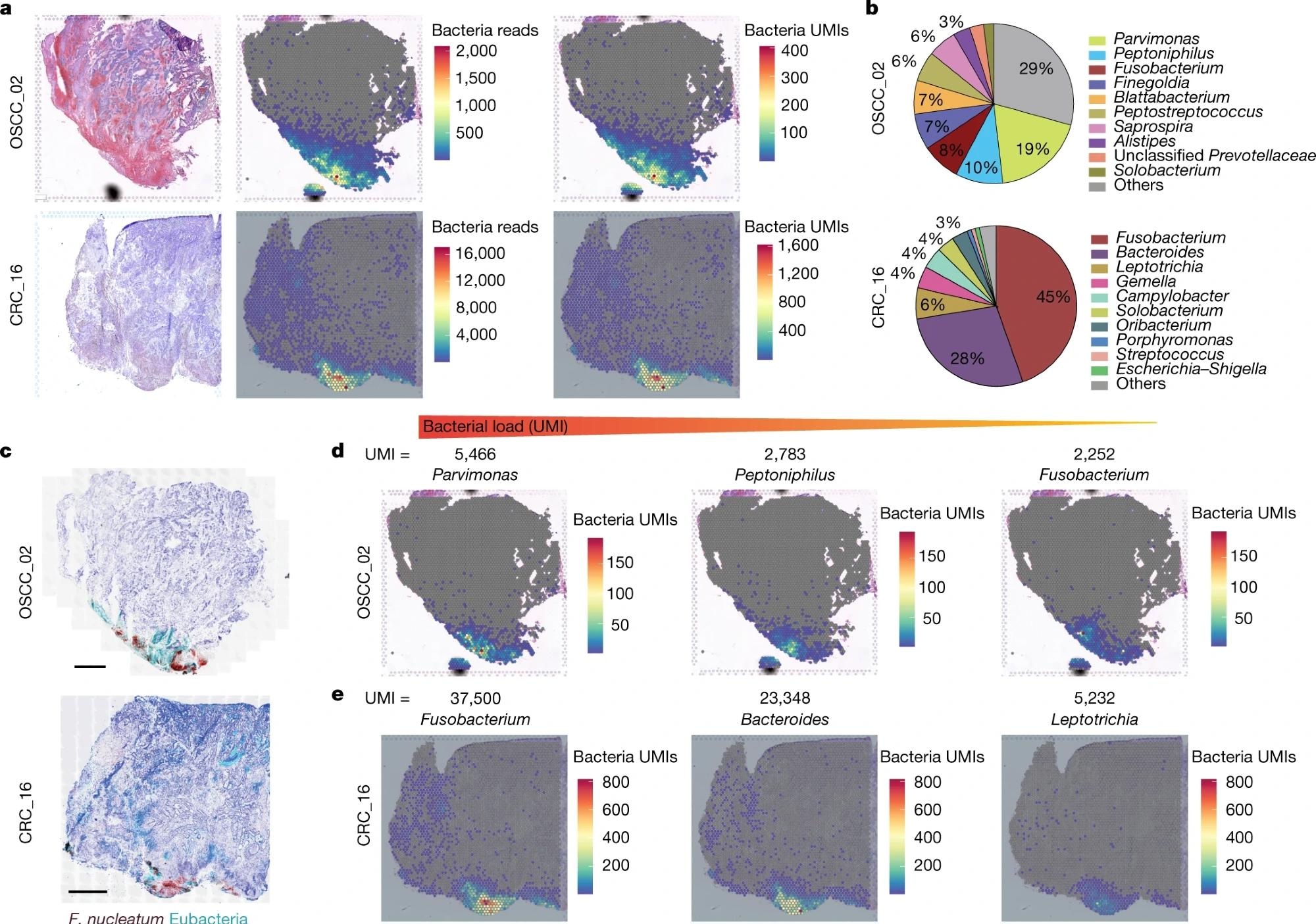 a, Haematoxylin and eosin (H&E) staining (left), spatial distribution of total bacterial reads (centre) and total UMI transcripts (right) throughout the tumour tissue in the 10x Visium capture slides from human OSCC and CRC specimens. b, Pie chart of the top 10 most dominant bacterial genera detected in the 10x Visium RNA-sequencing data from the OSCC and CRC tumours. c, RNAscope-FISH imaging showing the distribution of bacteria across the tumour tissue in a sequential slide following the 10x Visium section. The F. nucleatum probe is red and the eubacterial probe is cyan. Scale bars, 1 mm. d, Spatial distribution of Parvimonas, Peptoniphilus and Fusobacterium UMIs detected in the 10x Visium OSCC specimen data. e, Spatial distribution of Fusobacterium, Bacteroides and Leptotrichia UMIs detected in the 10x Visium CRC specimen data.