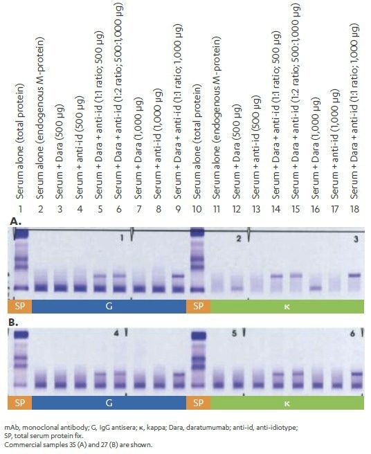 How to assess clinical response in multiple myeloma