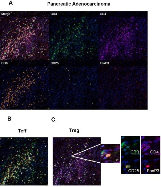 Detecting tissue-resident memory T cells in solid tumors