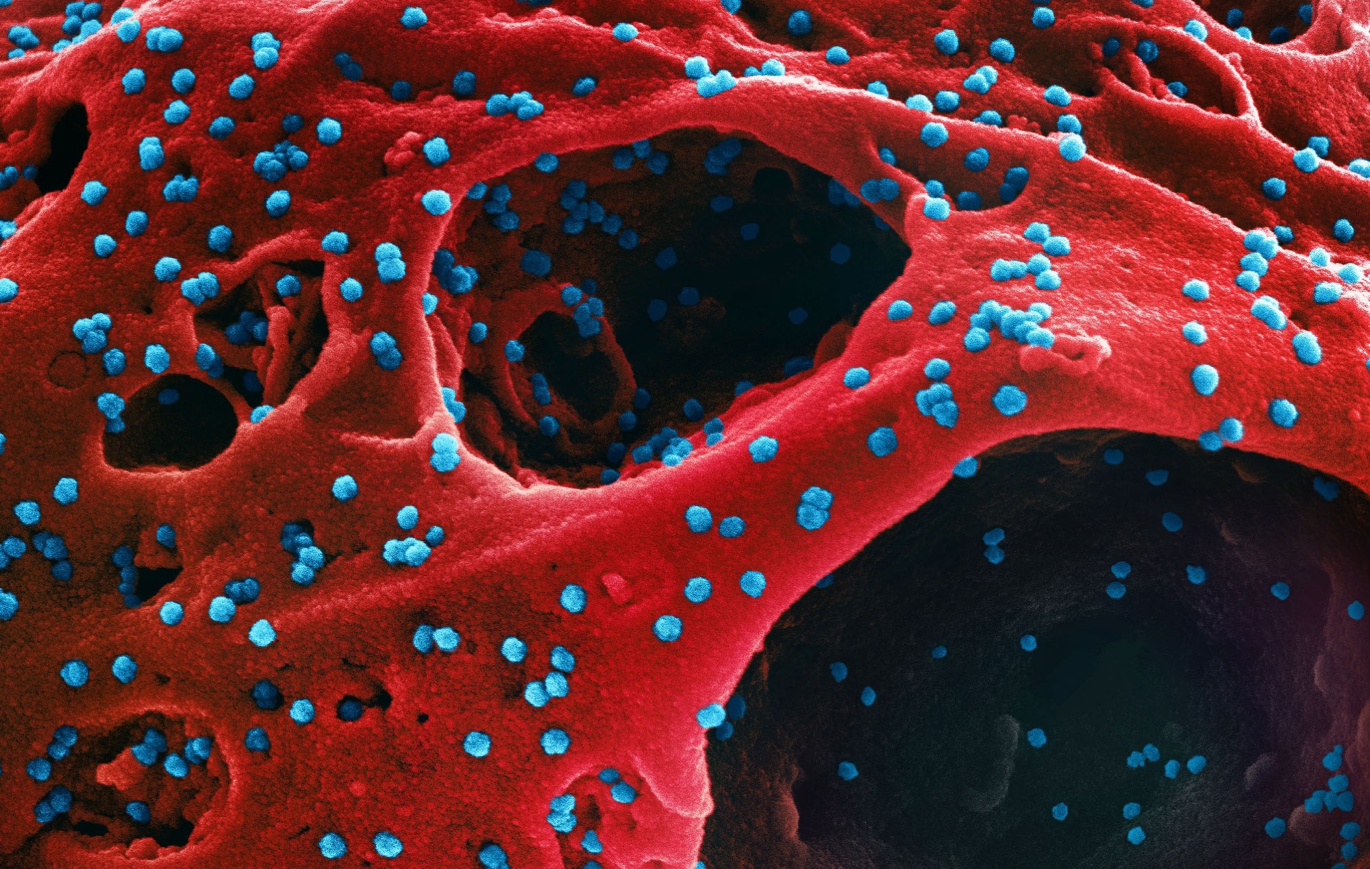 Short communication: SARS-CoV-2 viral shedding in vaccinated and unvaccinated persons: A case series. Image Credit: NIAID