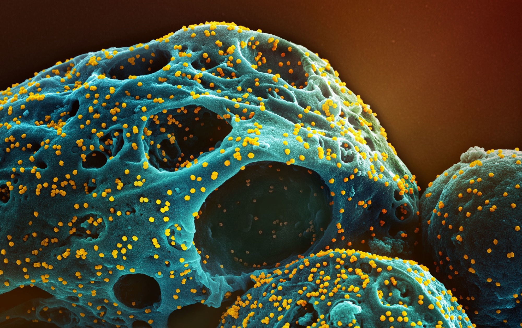 Study: Emergence and antibody evasion of BQ and BA.2.75 SARS-CoV-2 sublineages in the face of maturing antibody breadth at the population level. Image Credit: NIAID