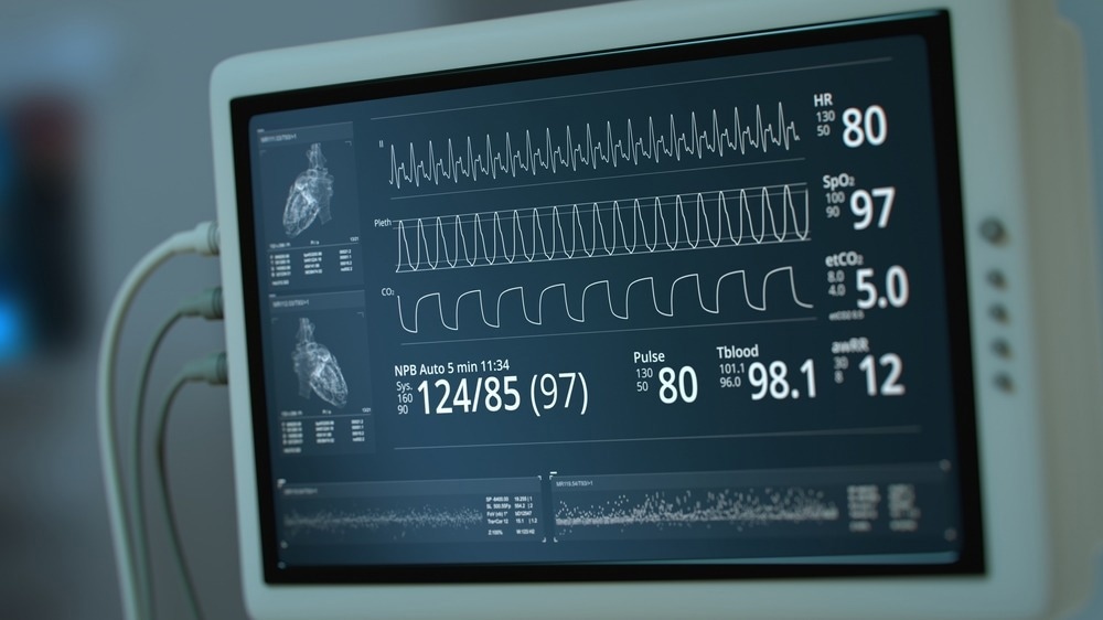 Study: Dapagliflozin in heart failure with improved ejection fraction: a prespecified analysis of the DELIVER trial. Image Credit: SquareMotion / Shutterstock.com