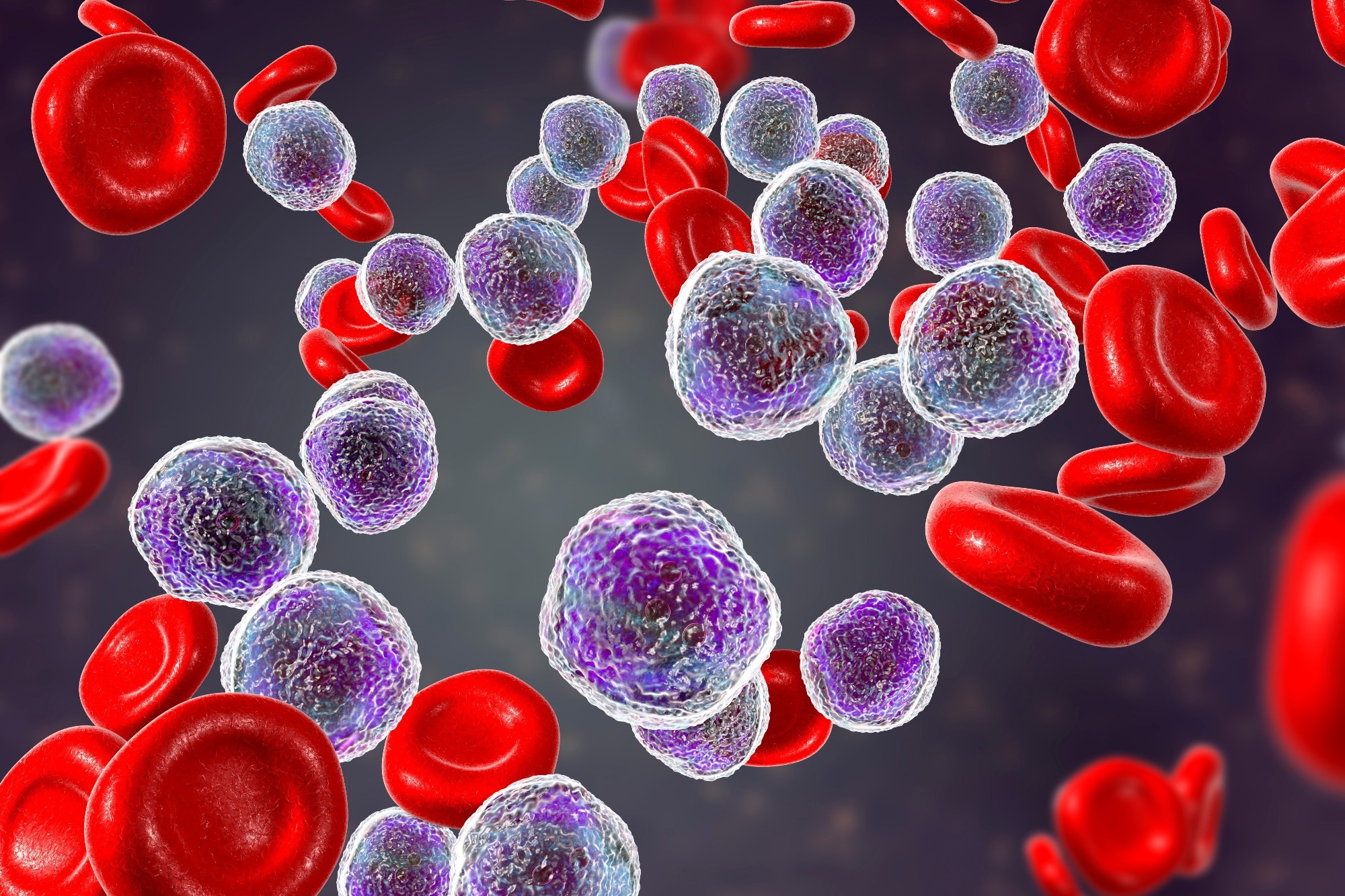 Study: Evaluation of the Association Between Congenital Cytomegalovirus Infection and Pediatric Acute Lymphoblastic Leukemia. Image Credit: Kateryna Kon/Shutterstock