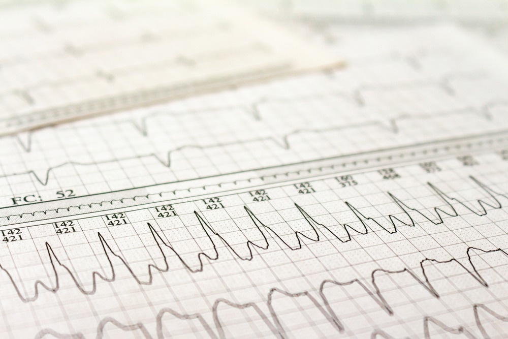 Study: Cardiac Arrhythmias in Pediatric Age: Are They Triggered by SARS-CoV-2 Infection? Image Credit: Horacio Selva/Shutterstock